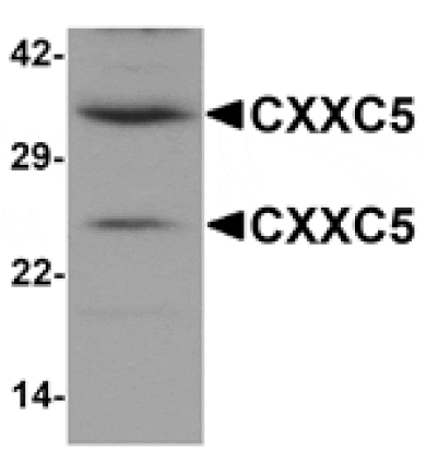 Western blot - CXXC5 Antibody from Signalway Antibody (25239) - Antibodies.com