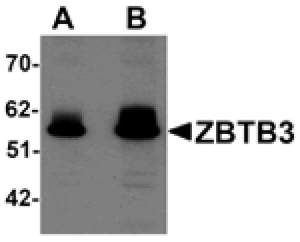 Western blot - ZBTB3 Antibody from Signalway Antibody (25242) - Antibodies.com