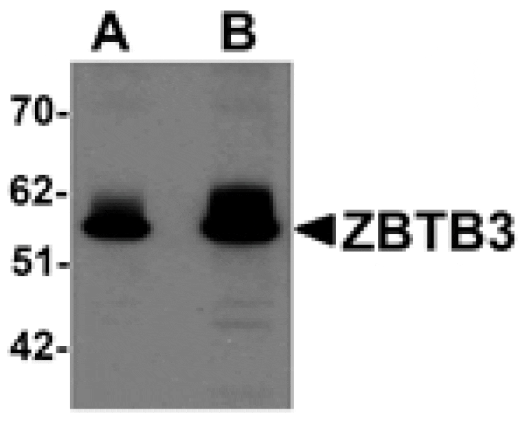 Western blot - ZBTB3 Antibody from Signalway Antibody (25242) - Antibodies.com