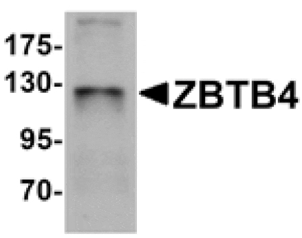 Western blot - ZBTB4 Antibody from Signalway Antibody (25243) - Antibodies.com