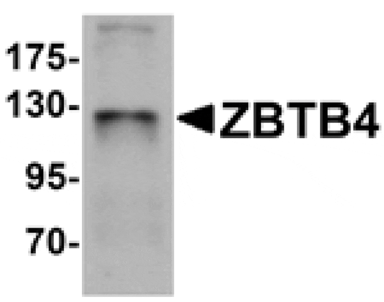Western blot - ZBTB4 Antibody from Signalway Antibody (25243) - Antibodies.com