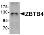 Western blot - ZBTB4 Antibody from Signalway Antibody (25243) - Antibodies.com