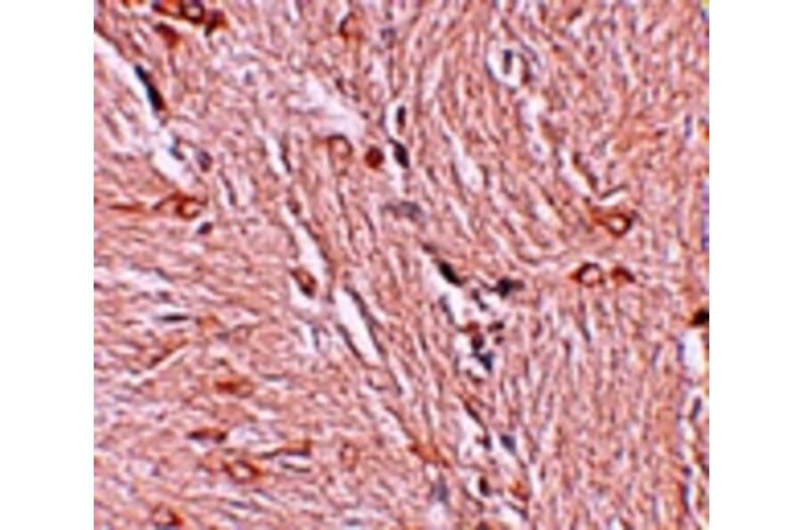Immunohistochemistry - ZBTB4 Antibody from Signalway Antibody (25243) - Antibodies.com