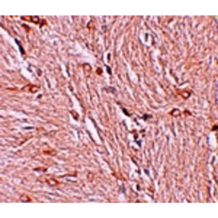 Immunohistochemistry - ZBTB4 Antibody from Signalway Antibody (25243) - Antibodies.com
