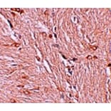 Immunohistochemistry - ZBTB4 Antibody from Signalway Antibody (25243) - Antibodies.com