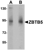 Western blot analysis of ZBTB5 in mouse brain tissue lysate with ZBTB5 antibody at (A) 1 and (B) 2 µg/mL.
