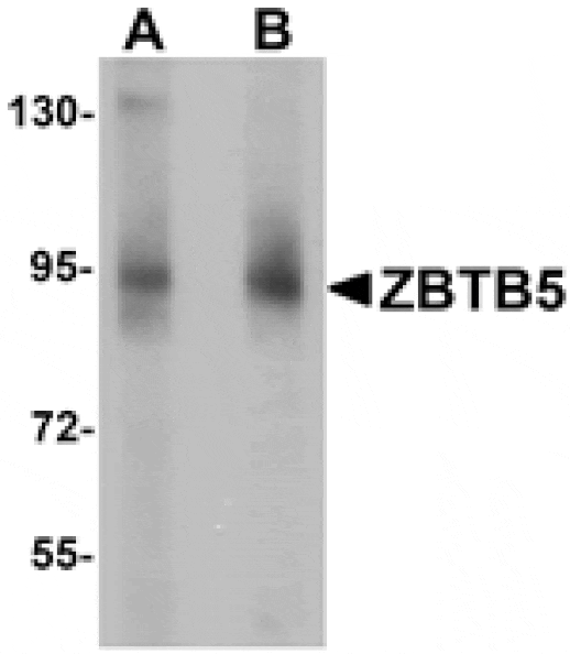 Western blot - ZBTB5 Antibody from Signalway Antibody (25244) - Antibodies.com