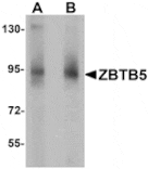 Western blot - ZBTB5 Antibody from Signalway Antibody (25244) - Antibodies.com