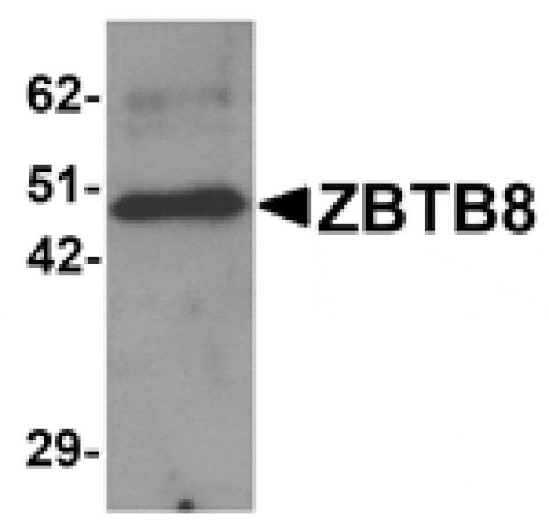 Western blot - ZBTB8 Antibody from Signalway Antibody (25247) - Antibodies.com