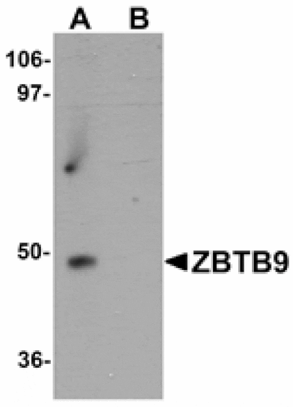 Western blot - ZBTB9 Antibody from Signalway Antibody (25248) - Antibodies.com