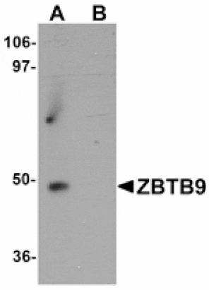 Western blot - ZBTB9 Antibody from Signalway Antibody (25248) - Antibodies.com