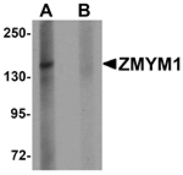 Western blot - ZMYM1 Antibody from Signalway Antibody (25249) - Antibodies.com