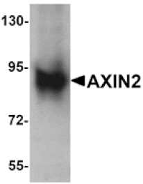 Western blot - AXIN2 Antibody from Signalway Antibody (25253) - Antibodies.com