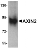 Western blot - AXIN2 Antibody from Signalway Antibody (25253) - Antibodies.com