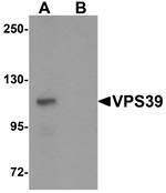 Western blot analysis of VPS39 in rat liver tissue lysate with VPS39 antibody at 0.5 µg/mL in (A) the absence and (B) the presence of blocking peptide.