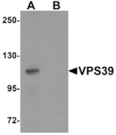 Western blot - VPS39 Antibody from Signalway Antibody (25263) - Antibodies.com