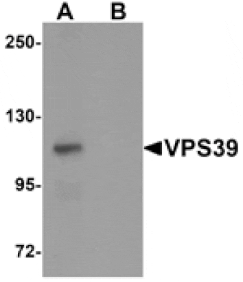 Western blot - VPS39 Antibody from Signalway Antibody (25263) - Antibodies.com