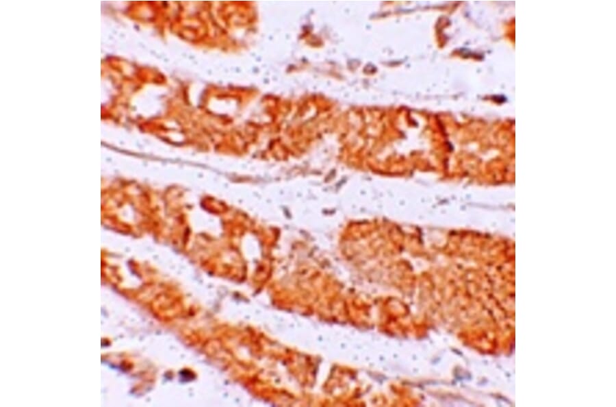 Immunohistochemistry - RHAMM Antibody from Signalway Antibody (25266) - Antibodies.com
