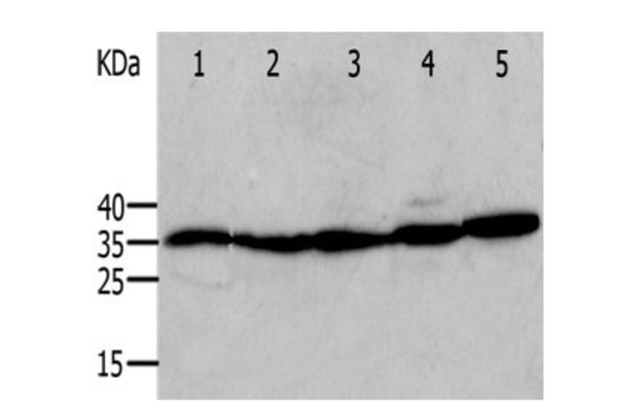 ANXA5 Antibody from Signalway Antibody (31009) - Antibodies.com