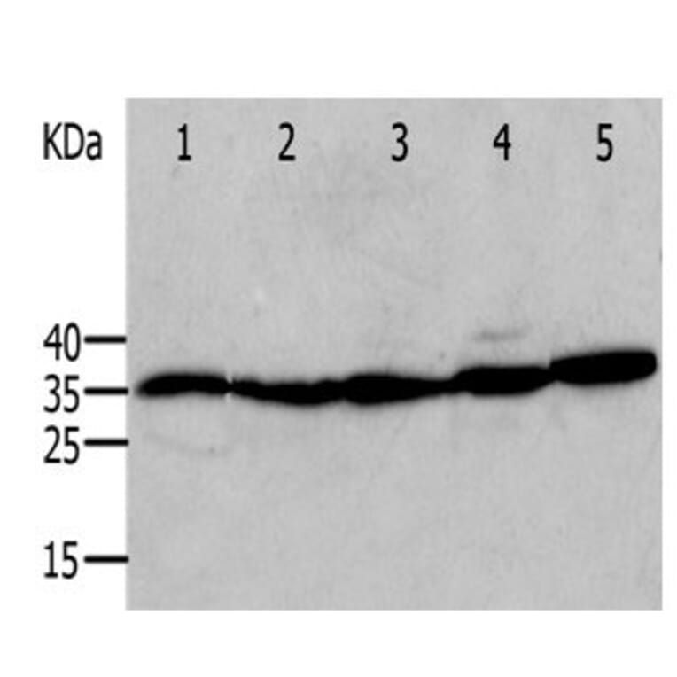ANXA5 Antibody from Signalway Antibody (31009) - Antibodies.com