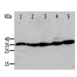 ANXA5 Antibody from Signalway Antibody (31009) - Antibodies.com