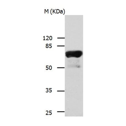 IL23R Antibody from Signalway Antibody (31023) - Antibodies.com