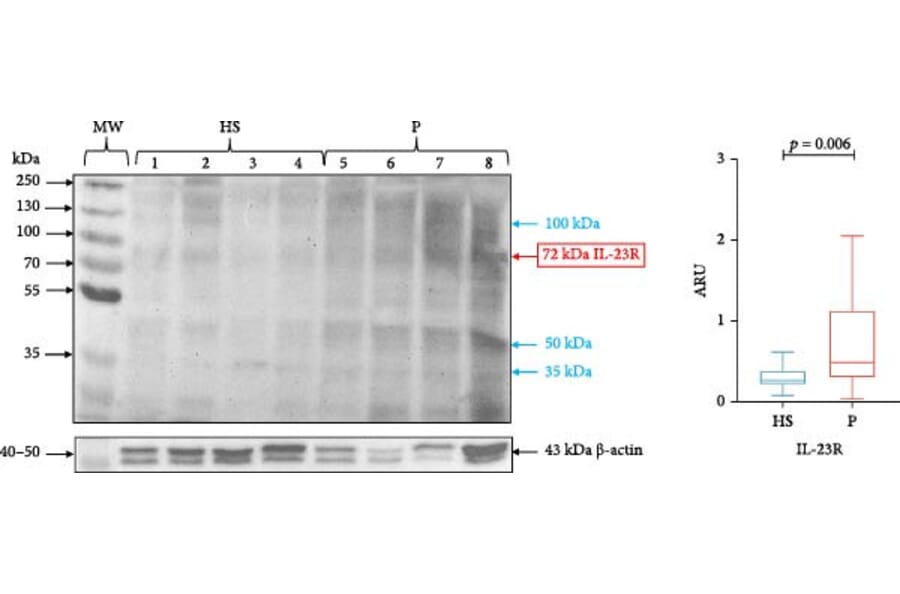 Western Blot - Anti-IL23R Antibody (A48090) - Antibodies.com