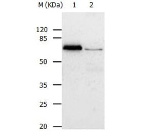 ABCB8 Antibody from Signalway Antibody (31025) - Antibodies.com