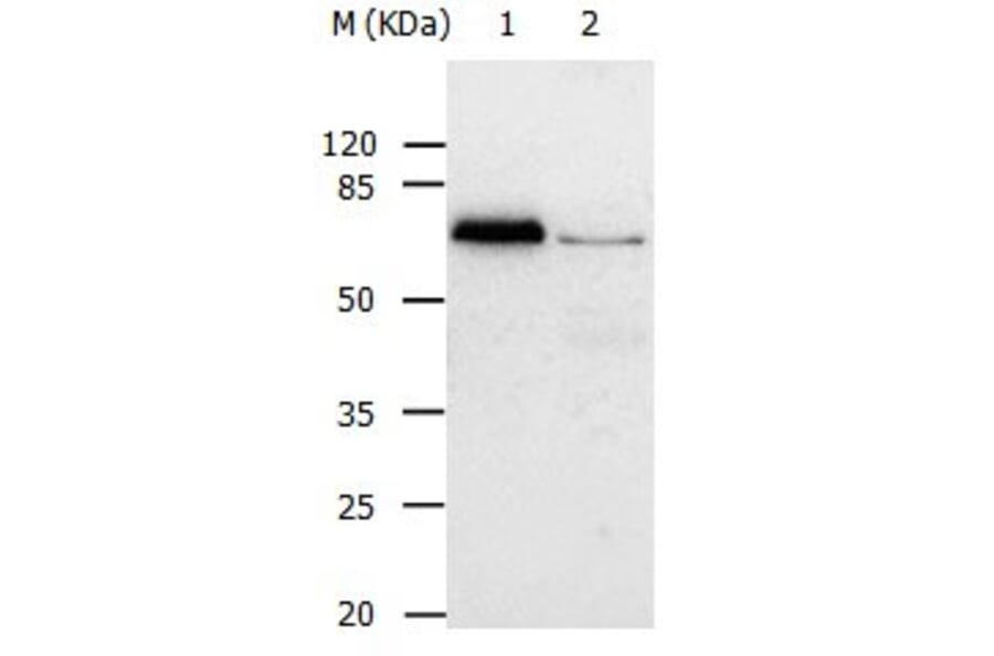 ABCB8 Antibody from Signalway Antibody (31025) - Antibodies.com