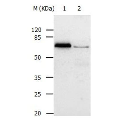 ABCB8 Antibody from Signalway Antibody (31025) - Antibodies.com