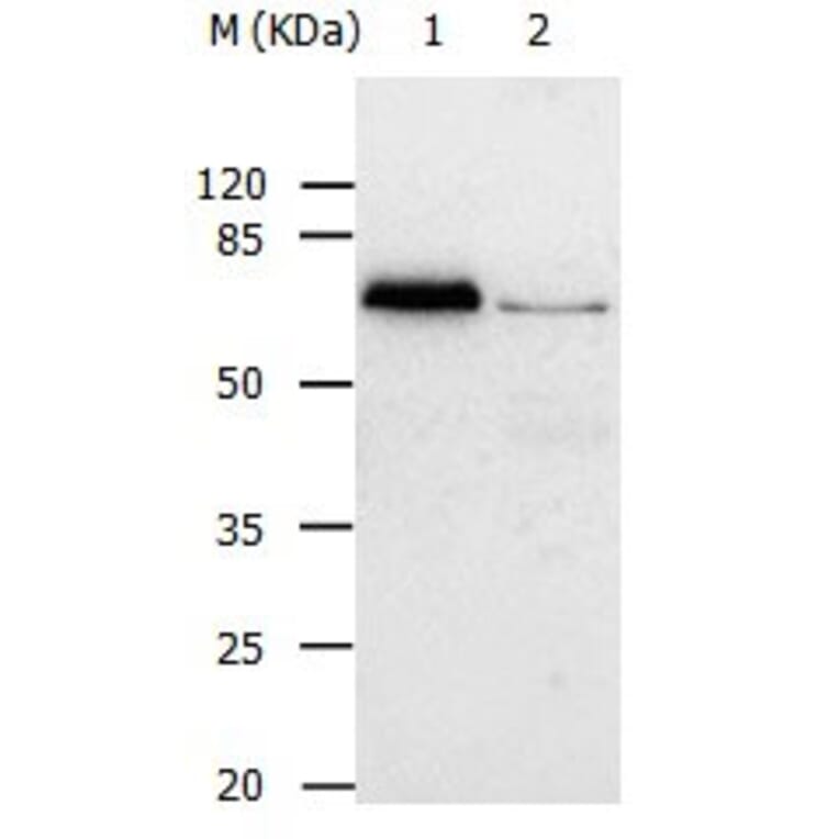 ABCB8 Antibody from Signalway Antibody (31025) - Antibodies.com