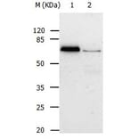 ABCB8 Antibody from Signalway Antibody (31025) - Antibodies.com