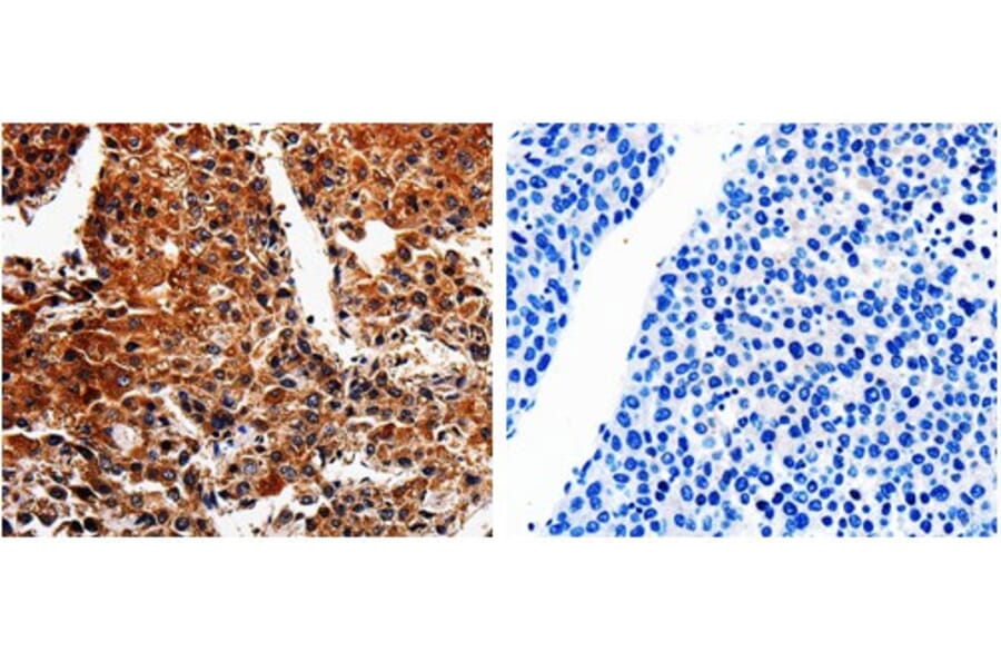 ABCB8 Antibody from Signalway Antibody (31025) - Antibodies.com