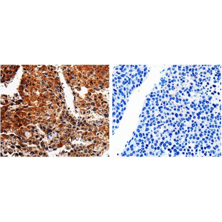 ABCB8 Antibody from Signalway Antibody (31025) - Antibodies.com