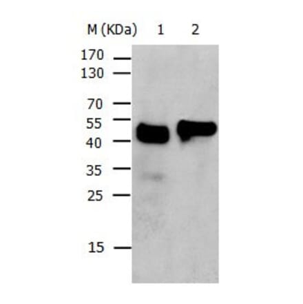 KRT17 Antibody from Signalway Antibody (31031) - Antibodies.com