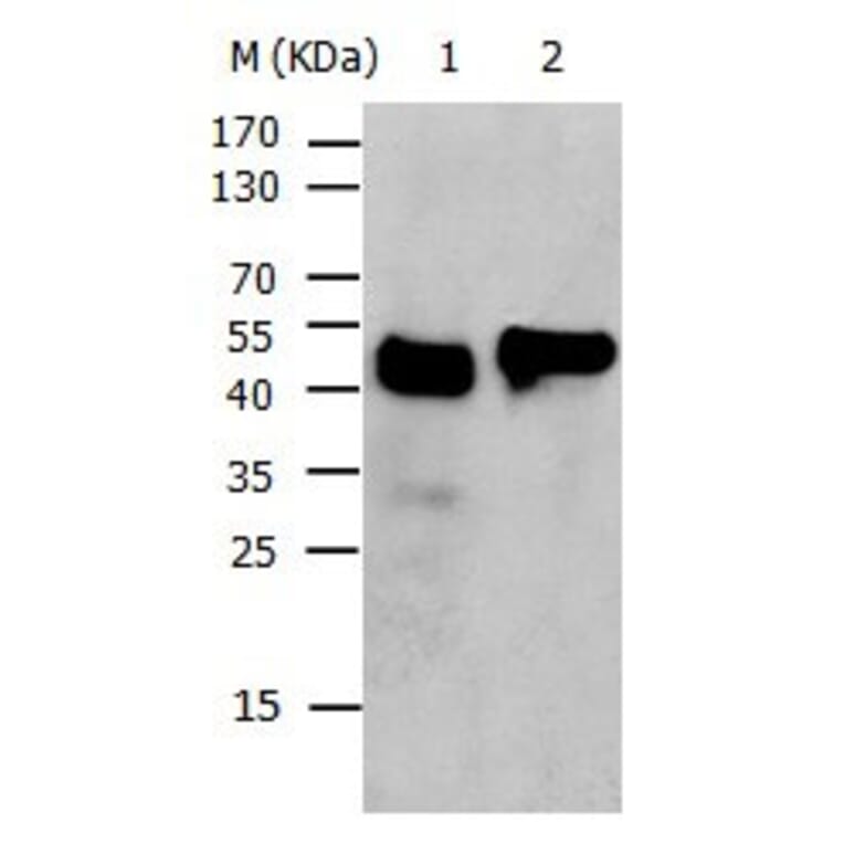 KRT17 Antibody from Signalway Antibody (31031) - Antibodies.com