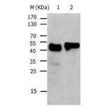 KRT17 Antibody from Signalway Antibody (31031) - Antibodies.com