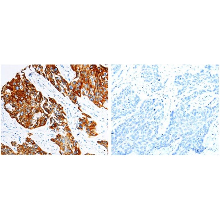 KRT17 Antibody from Signalway Antibody (31031) - Antibodies.com