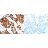 KRT17 Antibody from Signalway Antibody (31031) - Antibodies.com