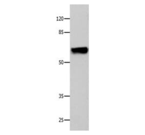 CNGA2 Antibody from Signalway Antibody (31060) - Antibodies.com