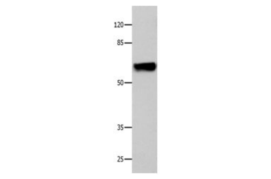 CNGA2 Antibody from Signalway Antibody (31060) - Antibodies.com
