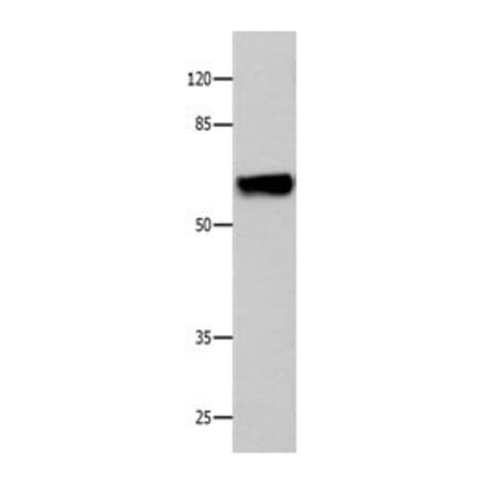 CNGA2 Antibody from Signalway Antibody (31060) - Antibodies.com