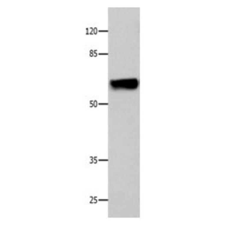 CNGA2 Antibody from Signalway Antibody (31060) - Antibodies.com