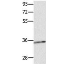 CCND1 Antibody from Signalway Antibody (31064) - Antibodies.com