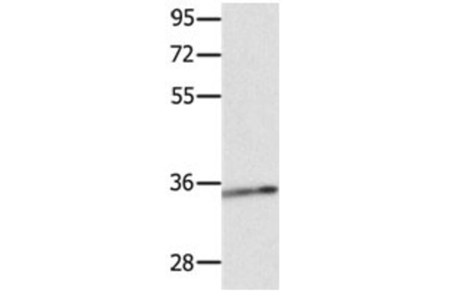 CCND1 Antibody from Signalway Antibody (31064) - Antibodies.com