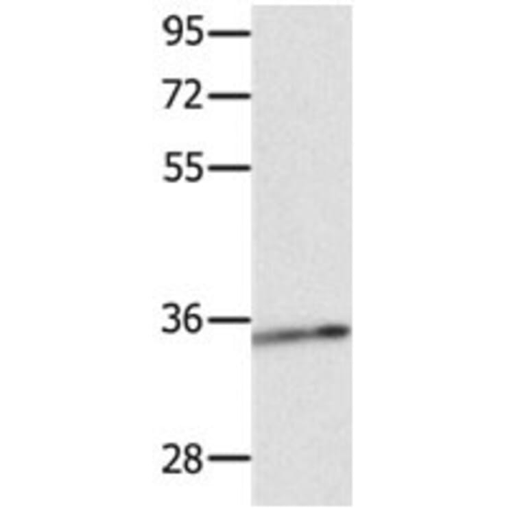 CCND1 Antibody from Signalway Antibody (31064) - Antibodies.com