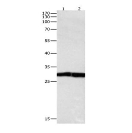 DUSP6 Antibody from Signalway Antibody (31069) - Antibodies.com