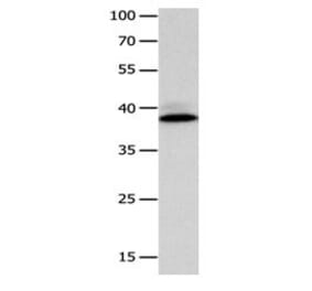 CFHR1 Antibody from Signalway Antibody (31079) - Antibodies.com