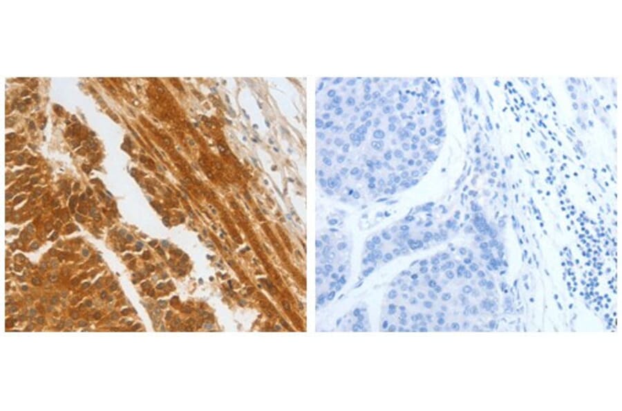 CFHR1 Antibody from Signalway Antibody (31079) - Antibodies.com