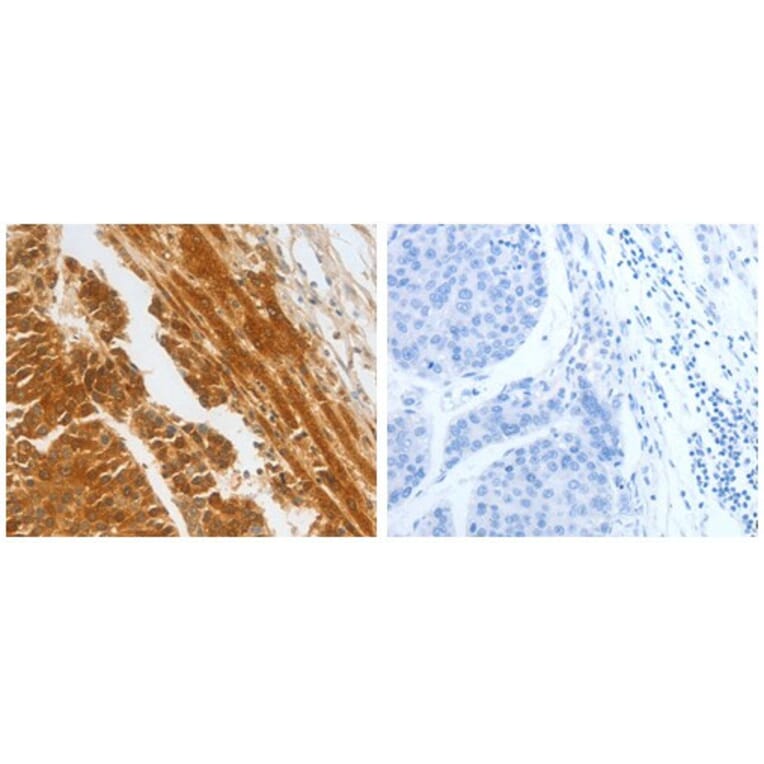 CFHR1 Antibody from Signalway Antibody (31079) - Antibodies.com